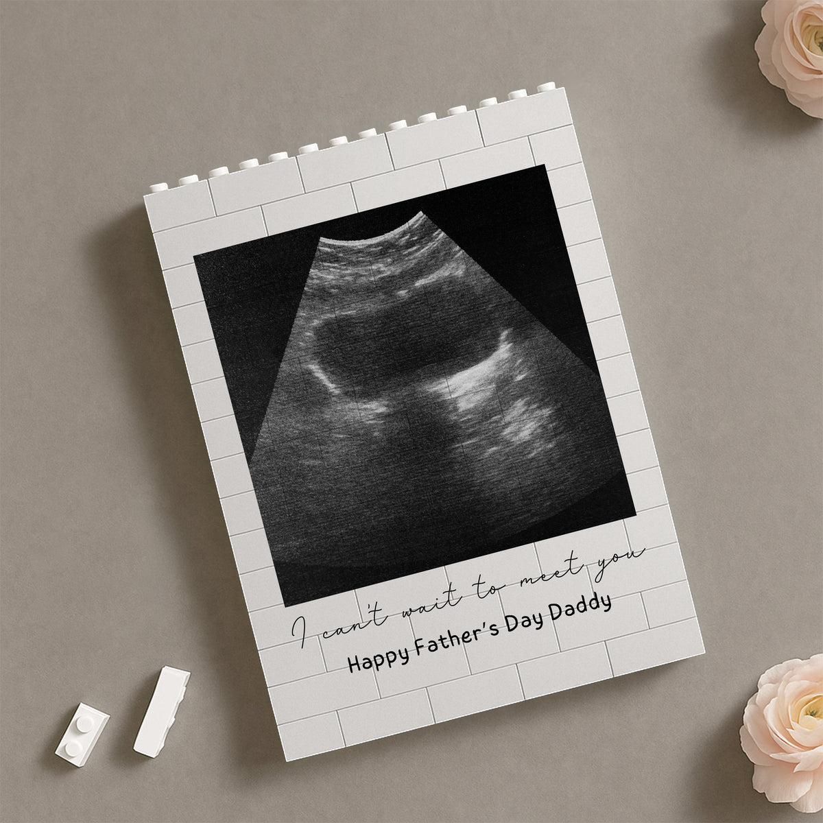 Custom Photo I Cannot Wait To Meet You Baby Scan Building Brick Blocks Happy Father's Day TH10 898853